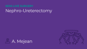 21UROP_VIEWR_DESIGN_vignettes_SMS Nephro-Ureterectomy